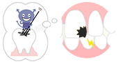 むし歯を予防したい